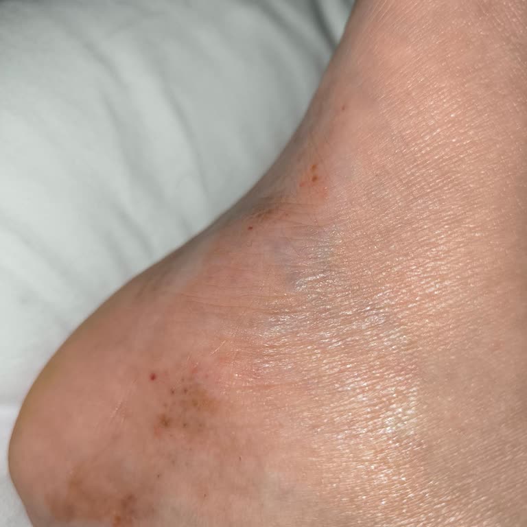 Watsons Clasy Care Kremi Sonrası Şiddetli Kaşıntı Ve Yaralar Nedeniyle Ücret İadesi Talebi