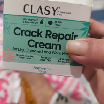 Watsons Clasy Care Kremi Sonrası Şiddetli Kaşıntı Ve Yaralar Nedeniyle Ücret İadesi Talebi