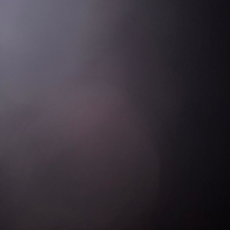 Prima Aktif Bebek Bezlerinde Sızdırma Sorunu Ve Güven Kaybı