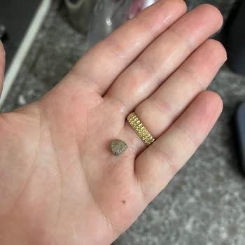 BİM Baldo Pirinçte Büyük Taş Çıktı