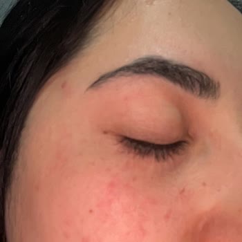 Newgen Yüz Serumu Şiddetli Yan Etkiler Ve Açıklama Talebi