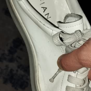 FLO'dan Aldığım Sneaker Ayakkabıda Açılmalar Ve Destek Reddi