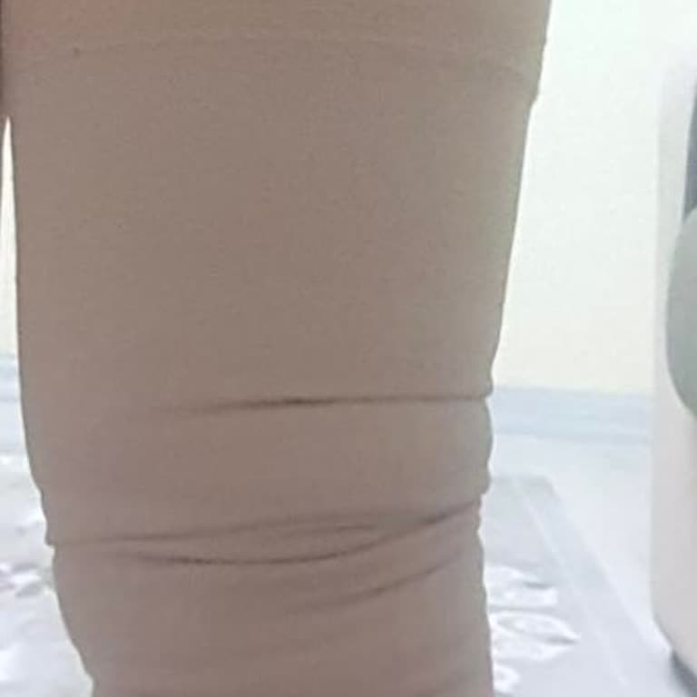 Fures Medikal İzmir'den Alınan Ürün Kısa Sürede Bozuldu