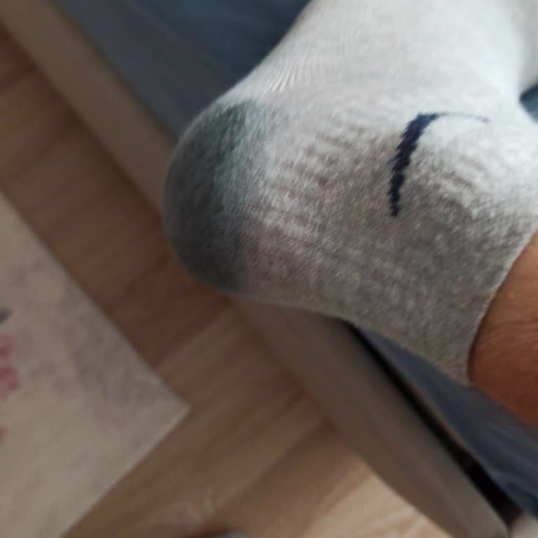 Oxide Botunun Çorapları Boyaması Ve Mağduriyetim İçin İade Talebi