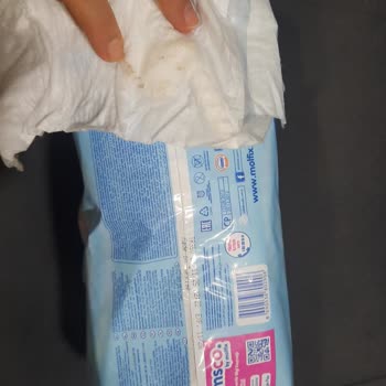 Molfix Bebek Bezinde Sert Cisim Ve Küflü Parça: Üretim Hatası