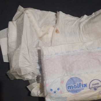 Molfix Bebek Bezinde Sert Cisim Ve Küflü Parça: Üretim Hatası