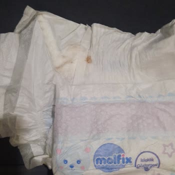 Molfix Bebek Bezinde Sert Cisim Ve Küflü Parça: Üretim Hatası