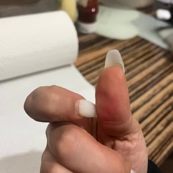 Kırılan Jel Tırnaklar Ve İhmalci Yaklaşım