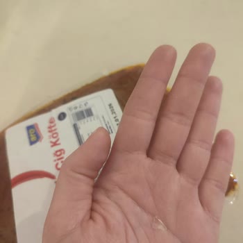 Aro Çiğ Köfte İçinde Cam Parçası, Dilim Kesildi