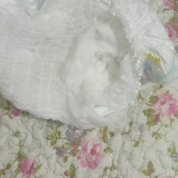 Gimsa Marketten Alınan Molfix Bezlerinde Dikiş Bozukluğu Ve Sağlık Riski