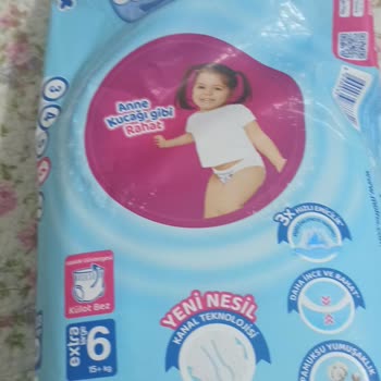 Gimsa Marketten Alınan Molfix Bezlerinde Dikiş Bozukluğu Ve Sağlık Riski