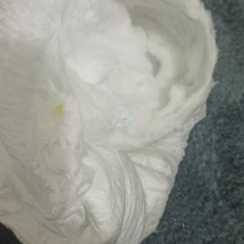 Gimsa Marketten Alınan Molfix Bezlerinde Dikiş Bozukluğu Ve Sağlık Riski