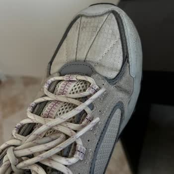 Skechers Stamina At Ayakkabısının Kısa Sürede Açılması Ve Çözüm Talebi