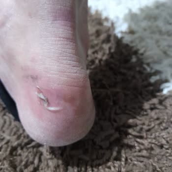 Derimod Botunda Topuk Vurması Ayağı Tahriş Etti, İade Reddi Hayal Kırıklığı!