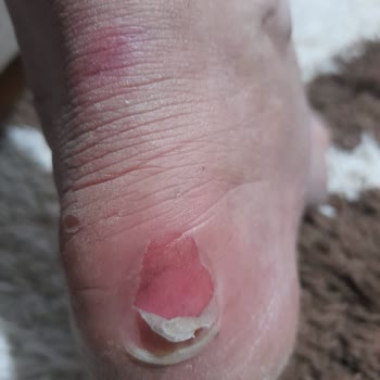 Derimod Botunda Topuk Vurması Ayağı Tahriş Etti, İade Reddi Hayal Kırıklığı!