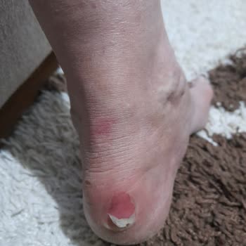 Derimod Botunda Topuk Vurması Ayağı Tahriş Etti, İade Reddi Hayal Kırıklığı!