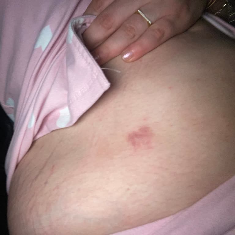 Vita Estetik Burun Estetiği Sonucundan Hiç Memnun Değilim