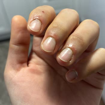 Gülümser Koç Estetik & Güzellik İşlem Sırasında Ve Sonrasında Hijyen Kurallarına Uyulmadı