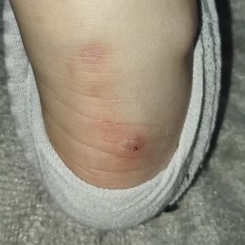 Harley Davidson Botunda Ciddi Kalite Problemleri Ve Satıcı Desteği Yok