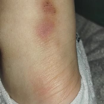 Harley Davidson Botunda Ciddi Kalite Problemleri Ve Satıcı Desteği Yok