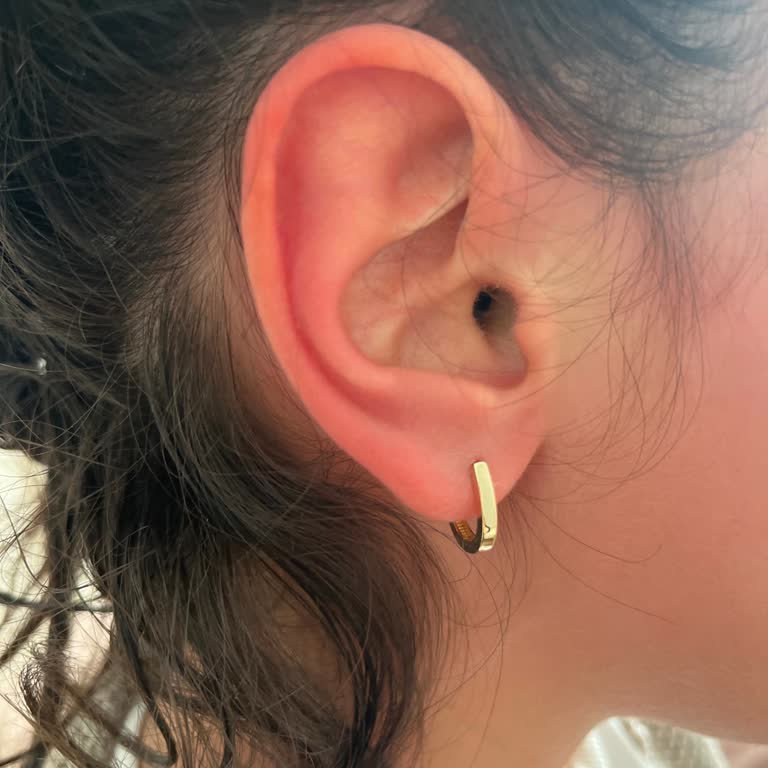 Sebamed Çocuk Şampuanı Yüzde Yanık Ve Kızarıklık Yarattı