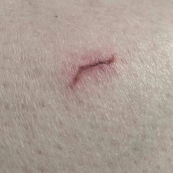 Almila Mobilya'dan Aldığım Mobilyalarda Sorun Yaşıyorum, Çözüm Sunulmuyor!