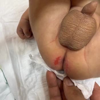 Prima Premium Care Bebek Bezinde Şiddetli Pişik Sorunu Ve İade Talebi