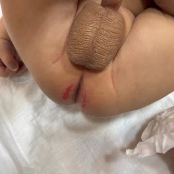 Prima Premium Care Bebek Bezinde Şiddetli Pişik Sorunu Ve İade Talebi