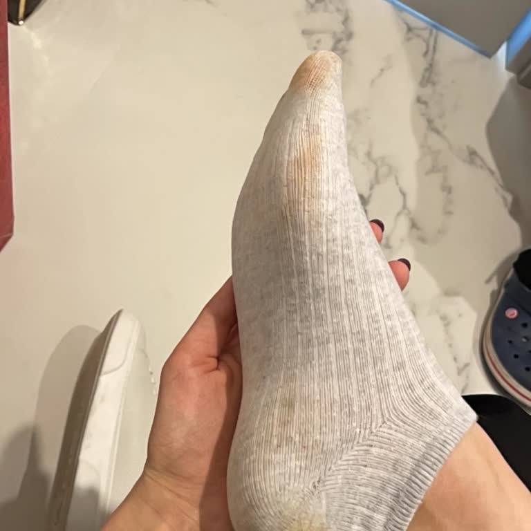 Ayakkabı İç Boyası Çorapları Renklendiriyor Ve Hayal Kırıklığı