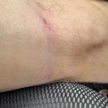 Botta Ayak Tahrişi Nedeniyle Değişim Talebinin Reddedilmesi