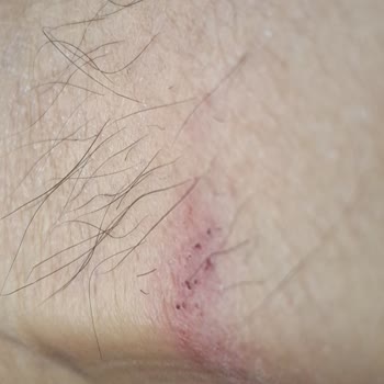 Botta Ayak Tahrişi Nedeniyle Değişim Talebinin Reddedilmesi