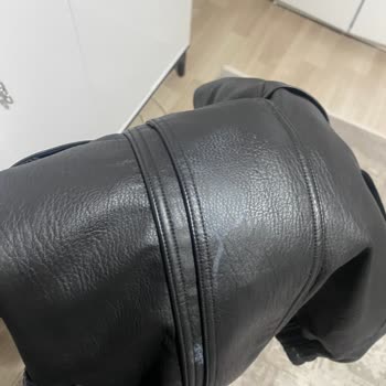 Deri Çekette Beyaz Lekeler: Hızlı Geri Dönüş Talebi