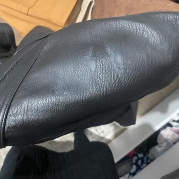 Deri Çekette Beyaz Lekeler: Hızlı Geri Dönüş Talebi