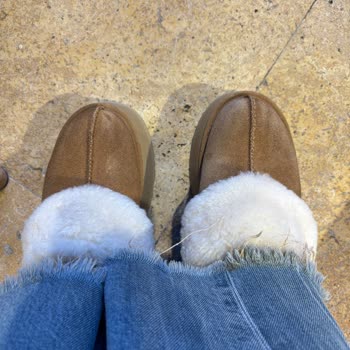 Ugg Sandaleti Kısa Sürede Renk Ve Doku Kaybı Yaşadı, Satıcı Kullanıcı Hatası İddiası Getirdi