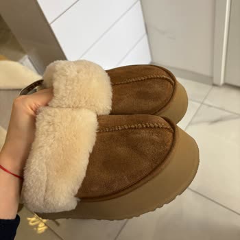 Ugg Sandaleti Kısa Sürede Renk Ve Doku Kaybı Yaşadı, Satıcı Kullanıcı Hatası İddiası Getirdi