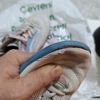 Ayakkabılar Kısa Sürede Açıldı Ve Eğildi, Mağaza Üretim Hatasını Reddetti