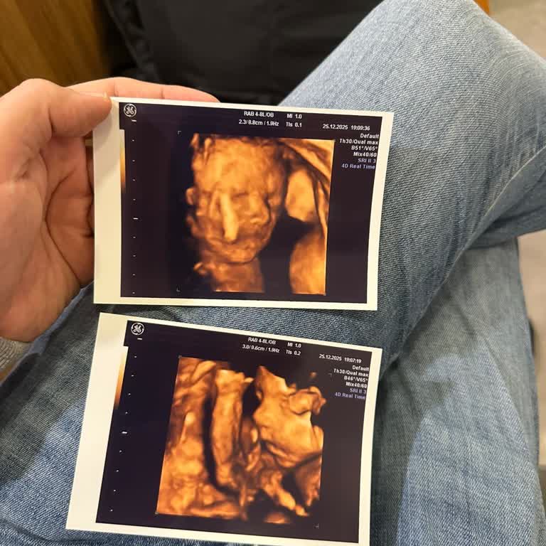 Yeni Doğan Desteği Olumsuz Değerlendirme Ve Açıklama Talebi