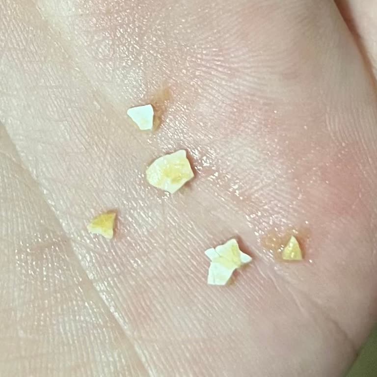 Buğdayın Sesi Fırın Üretim Hatası