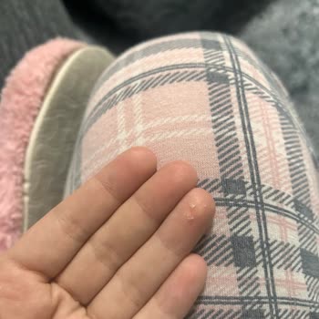 Molfix Maxi Plus Bebek Bezinde Kristal Tanecikler Ve Göbek Tahrişi