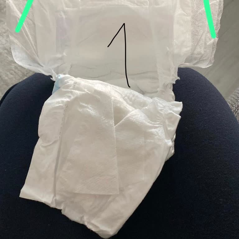 Molfix 6 Numaralı Bebek Bezi Bel Kısmı Kısa Ve Kayıyor