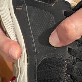 Skechers Ayakkabısındaki Açılma Ve Kalite Sorunu: Değişim Veya İade Talebi