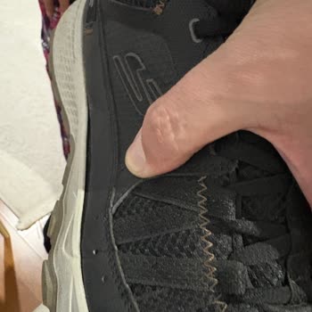 Skechers Ayakkabısındaki Açılma Ve Kalite Sorunu: Değişim Veya İade Talebi