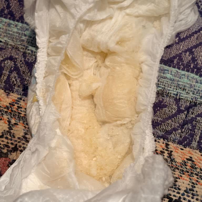 Molfix Ultra Advantage Pack Çocuk Bezinde Sızıntı Ve Granül Kaçağı