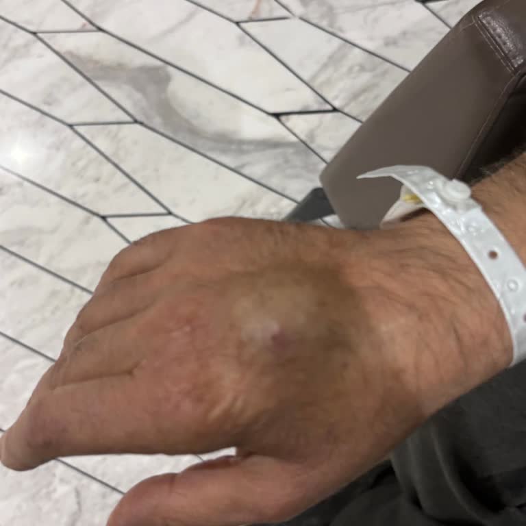 Medicana Sağlık Grubu Biyopsi Sonrası Saatlerce Aç Beklemek Ve Kontrolsüz Anestezi Uygulaması