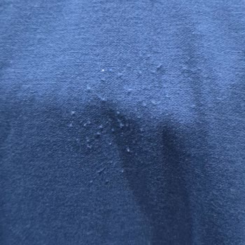 LCW Çocuk Eşofman Takımında Bitlenme: Tam İade Talebi