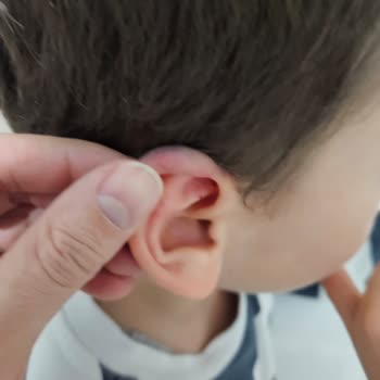 Akapedya Anaokulu'nda Çocuğuma Uygulanan Şiddet Ve İhmal