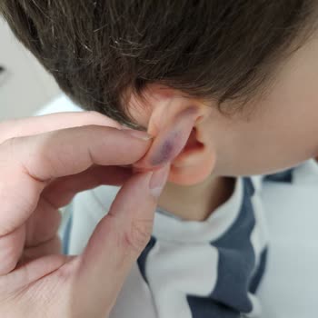 Akapedya Anaokulu'nda Çocuğuma Uygulanan Şiddet Ve İhmal