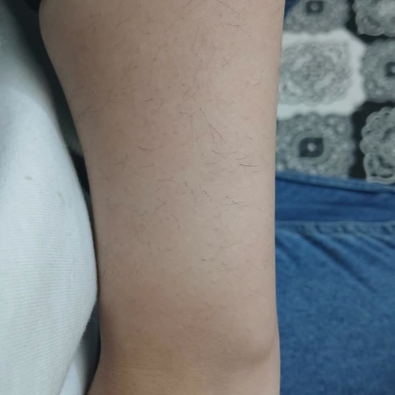 SB Güzellik Merkezi (İzmir) İşlem Kalitesi Nedeniyle 6.500 TL İade Talebi