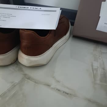 Ayakkabının Sağ Topuğu Eridi, Trendyol Kullanıcı Hatası İddiası