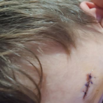 Burhaniye Belediyesi Ören Parkında Çocuk Güvenliği İhmali Ve Acil Önlem Talebi